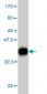 PARK2 Antibody (monoclonal) (M01)