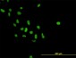 PARP1 Antibody (monoclonal) (M01)