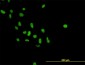 PARP1 Antibody (monoclonal) (M01)