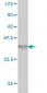 PARP1 Antibody (monoclonal) (M01)