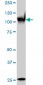 PARP1 Antibody (monoclonal) (M01)