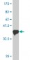 PASD1 Antibody (monoclonal) (M06)