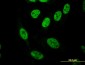 PASD1 Antibody (monoclonal) (M08)