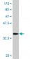 PASD1 Antibody (monoclonal) (M08)