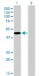 PAX5 Antibody (monoclonal) (M01)