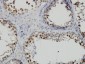 PBK Antibody (monoclonal) (M07)