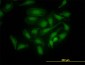 PBK Antibody (monoclonal) (M11)