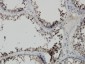 PBK Antibody (monoclonal) (M11)