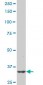 PBK Antibody (monoclonal) (M12)