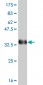 PBX3 Antibody (monoclonal) (M01)