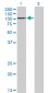 PCAF Antibody (monoclonal) (M02)