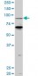 PCAF Antibody (monoclonal) (M04)