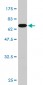 PCBP2 Antibody (monoclonal) (M07)