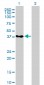 PCBP2 Antibody (monoclonal) (M07)