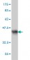 PCDH1 Antibody (monoclonal) (M01)