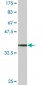 PCDH10 Antibody (monoclonal) (M07)