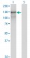 PCDH10 Antibody (monoclonal) (M07)