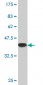 PCGF2 Antibody (monoclonal) (M04)