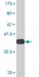 PCGF2 Antibody (monoclonal) (M05)