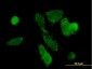 PCK1 Antibody (monoclonal) (M01)