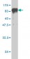 PCK1 Antibody (monoclonal) (M01)