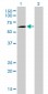 PCK1 Antibody (monoclonal) (M01)