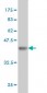 PCMT1 Antibody (monoclonal) (M02)