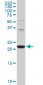 PCMT1 Antibody (monoclonal) (M02)