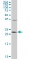 PCMT1 Antibody (monoclonal) (M02)