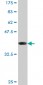 PCYT1A Antibody (monoclonal) (M02)
