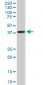 PCYT1A Antibody (monoclonal) (M02)