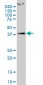 PCYT1A Antibody (monoclonal) (M02)