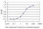 PCYT1A Antibody (monoclonal) (M03)