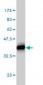 PCYT1A Antibody (monoclonal) (M03)