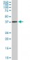 PCYT1A Antibody (monoclonal) (M03)