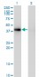 PCYT1A Antibody (monoclonal) (M03)