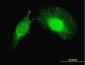 PDCD6IP Antibody (monoclonal) (M01)