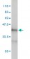 PDCD6IP Antibody (monoclonal) (M01)