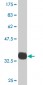 PDLIM1 Antibody (monoclonal) (M02)