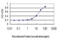 PDLIM5 Antibody (monoclonal) (M01)