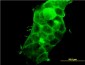 PDLIM5 Antibody (monoclonal) (M01)