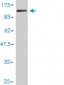 PDLIM5 Antibody (monoclonal) (M01)