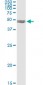 PDLIM7 Antibody (monoclonal) (M01)