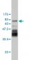 PDLIM7 Antibody (monoclonal) (M01)