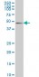 PDLIM7 Antibody (monoclonal) (M01)