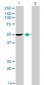 PDLIM7 Antibody (monoclonal) (M01)