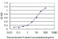 PDLIM7 Antibody (monoclonal) (M01)
