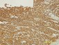 PDZK1 Antibody (monoclonal) (M01)