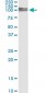 PECAM1 Antibody (monoclonal) (M01)