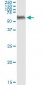 PEPD Antibody (monoclonal) (M01)